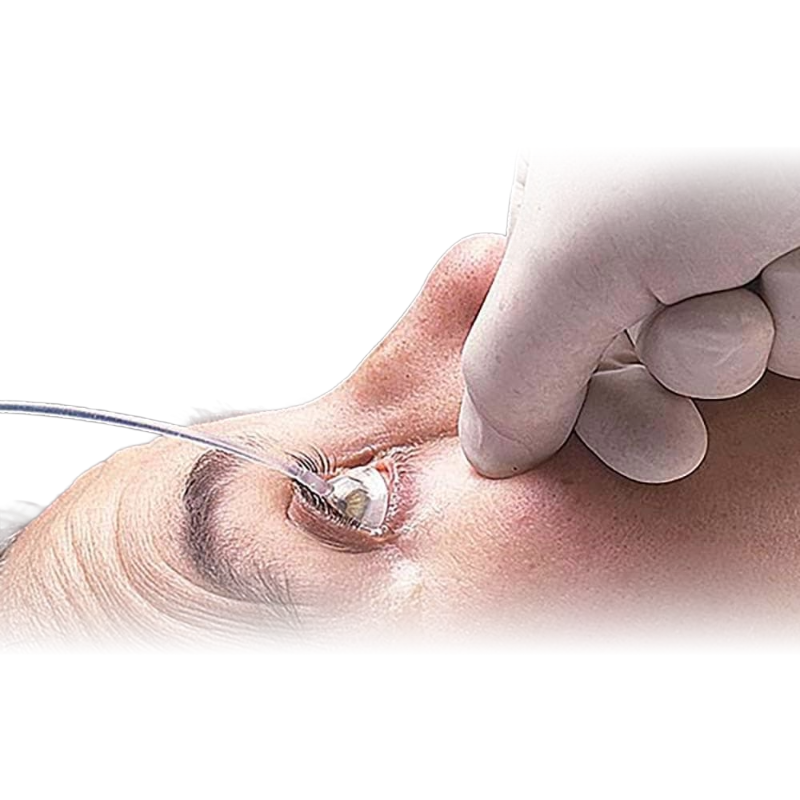 Morgan Lenses Individual Sterile (12)